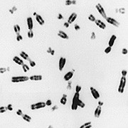 How Do Cells Handle Too Many Gene Copies?